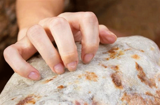 Parmakta Egzama Belirtileri ve Tedavisi